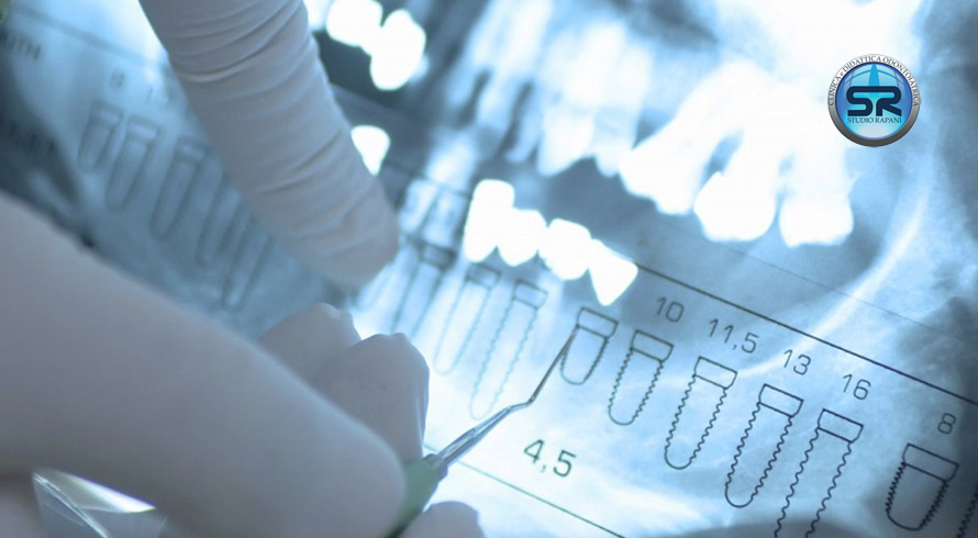 Diagnosi radiologica in odontoiatria
